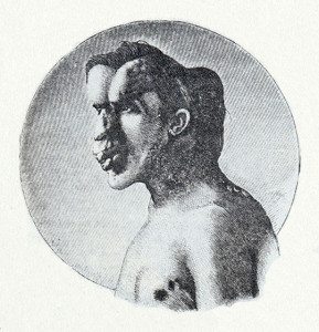 Elephant man